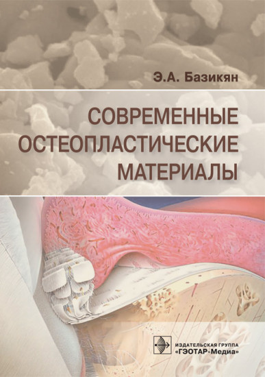 Современные остеопластические материалы