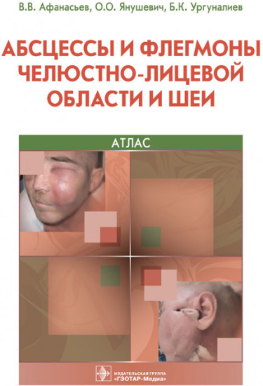 Абсцессы и флегмоны челюстно-лицевой области и шеи. Атлас. Учебное пособие