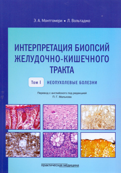 Интерпретация биопсий желудочно-кишечного тракта. Руководство. Том 1. Неопухолевые болезни