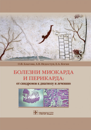 Болезни миокарда и перикарда. От синдромов к диагнозу и лечению
