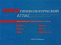 Онкогинекологический атлас. Классификация и определение стадии опухолей. Принципы диагностики и лечения
