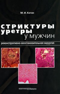 Стриктуры уретры у мужчин. Реконструктивно-восстановительная хирургия