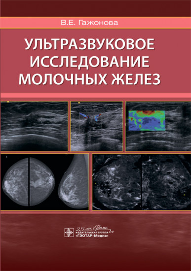 Ультразвуковое исследование молочных желез