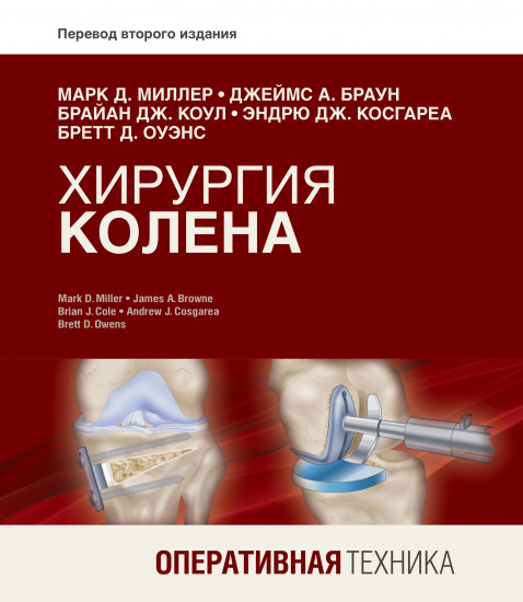 Хирургия колена. Оперативная техника
