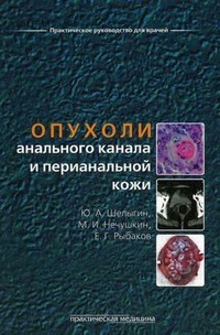 Опухоли анального канала и перианальной кожи. Практическое руководство для врачей