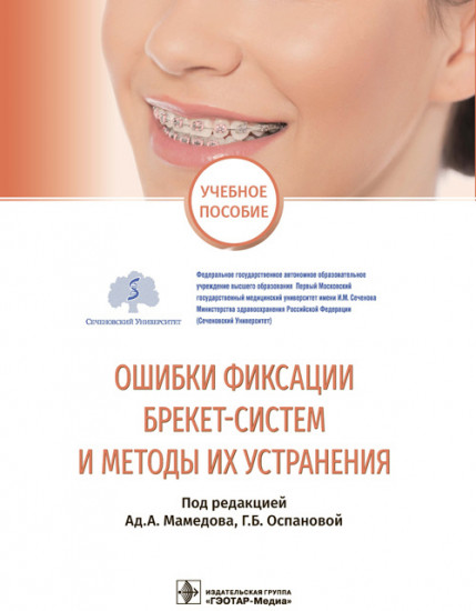 Ошибки фиксации брекет-систем и методы их устранения