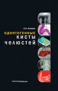 Одонтогенные кисты челюстей