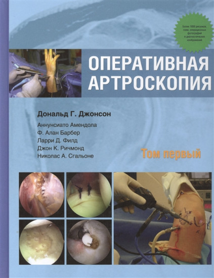 Оперативная артроскопия. Том 1
