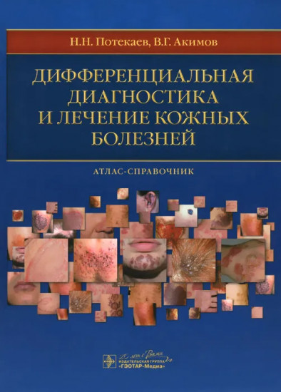 Дифференциальная диагностика и лечение кожных болезней. Атлас-справочник
