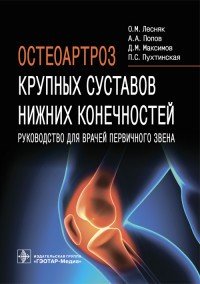 Остеоартроз крупных суставов нижних конечностей. Руководство для врачей первичного звена