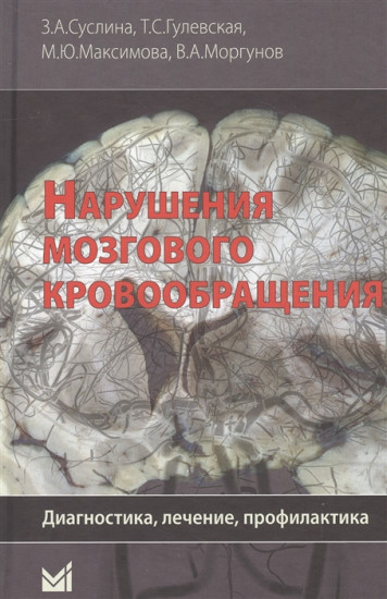 Нарушения мозгового кровообращения. Диагностика, лечение, профилактика. Руководство