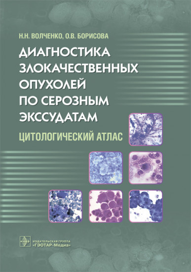 Диагностика злокачественных опухолей по серозным экссудатам. Цитологический атлас