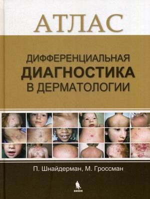 Дифференциальная диагностика в дерматологии. Атлас