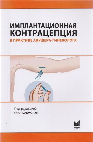 Имплантационная контрацепция в практике акушера-гинеколога. Руководство