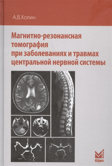Магнитно-резонансная томография при заболеваниях и травмах центральной нервной системы